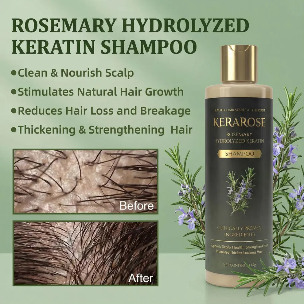 Kerarose Rosemary Shampoo For Hair Growth...